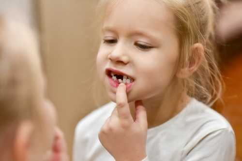 乳牙萌出前如何保持寶寶的口腔健康？