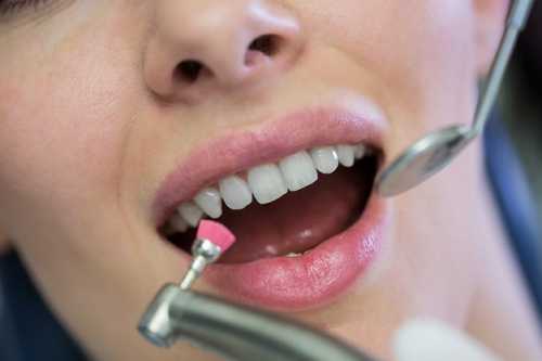 補牙的材料都有哪些？