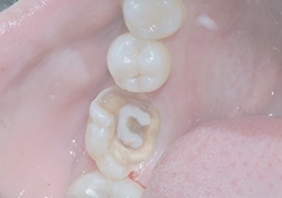 深圳杜牙根收費