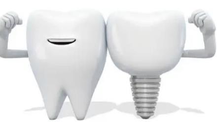 牙齒種植的術後護理