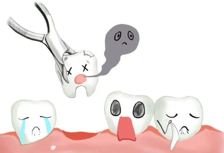 牙松到什麼程度要拔牙？拔牙後旁邊的牙齒會不會松