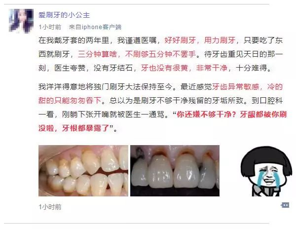 杭州妹嘅牙齒超白，一張嘴竟然被醫生罵痛：22顆牙全要補！