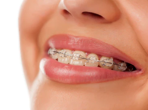 這是保護牙齒，最長期最有效的方法了！