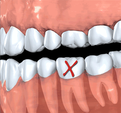 你對牙科治療的誤會太深了？