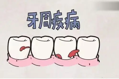 牙齒健康好重要！一起認識牙周病