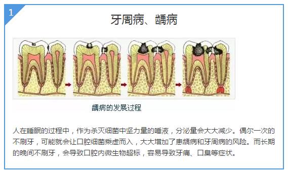 睇咗呢d，你仲敢睡前唔刷牙嗎？