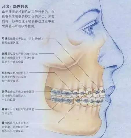 【牙齒正畸】矯牙好抽象？漫畫秒懂！