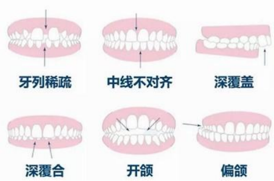 珠海箍牙邊度好：口腔醫院與正畸醫生誰更重要？