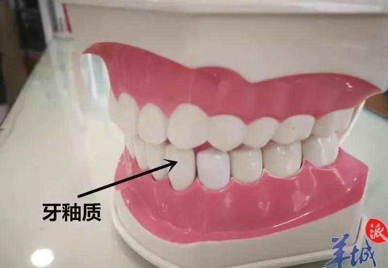 牙齒反覆痛後又不痛了，係自愈咗嗎？你冇高興太早