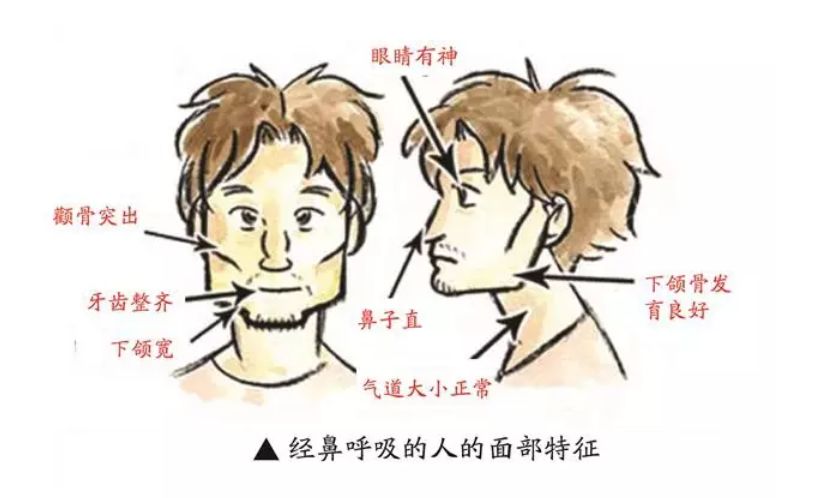 點解牙醫一眼就能看出孩子長期有口呼吸嘅習慣？