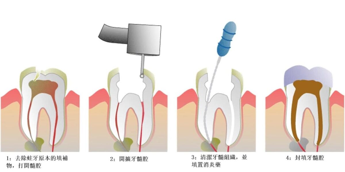 澳門杜牙根價錢