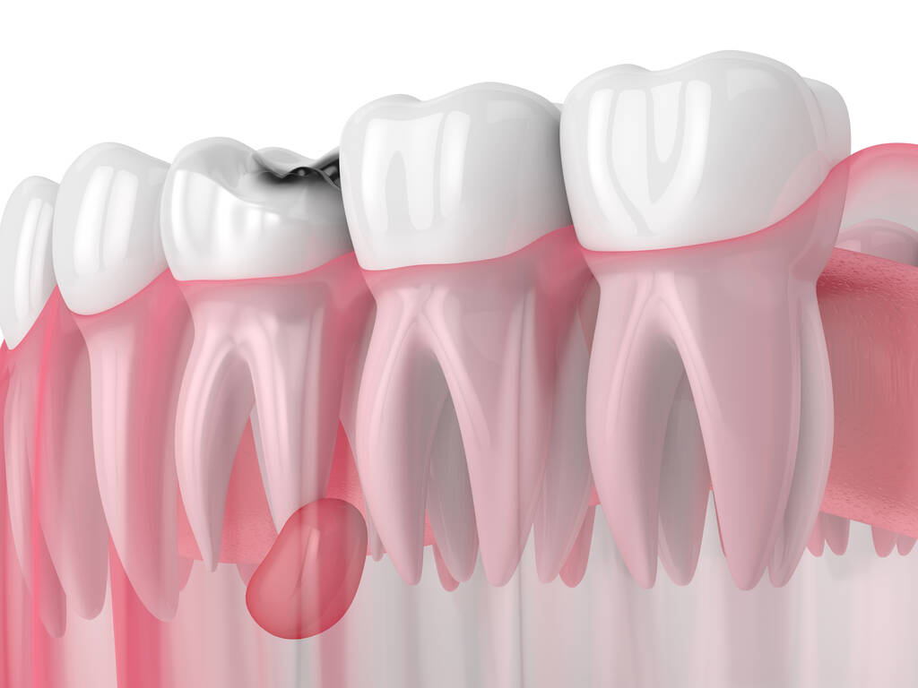 為了孩子！這20種牙頜畸形問題需要在12歲前解決