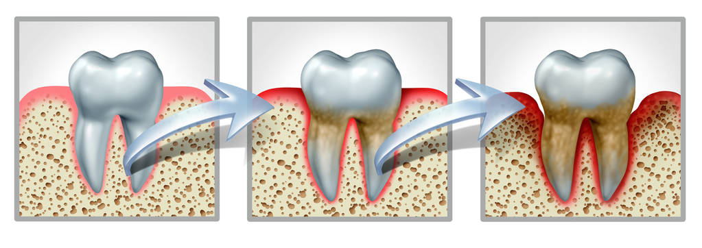 牙周炎、牙齒畸形、缺牙，這些口腔問題，真的