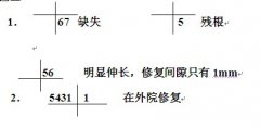 澳門鄭小姐正畸修復聯合治療病例