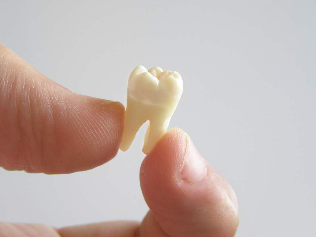 拔牙會損傷神經嗎
