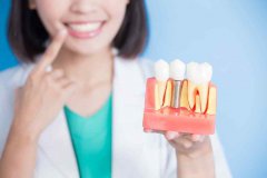 關於植牙優缺點，你知多少？