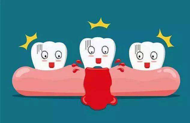 牙齦炎和牙周炎的區別